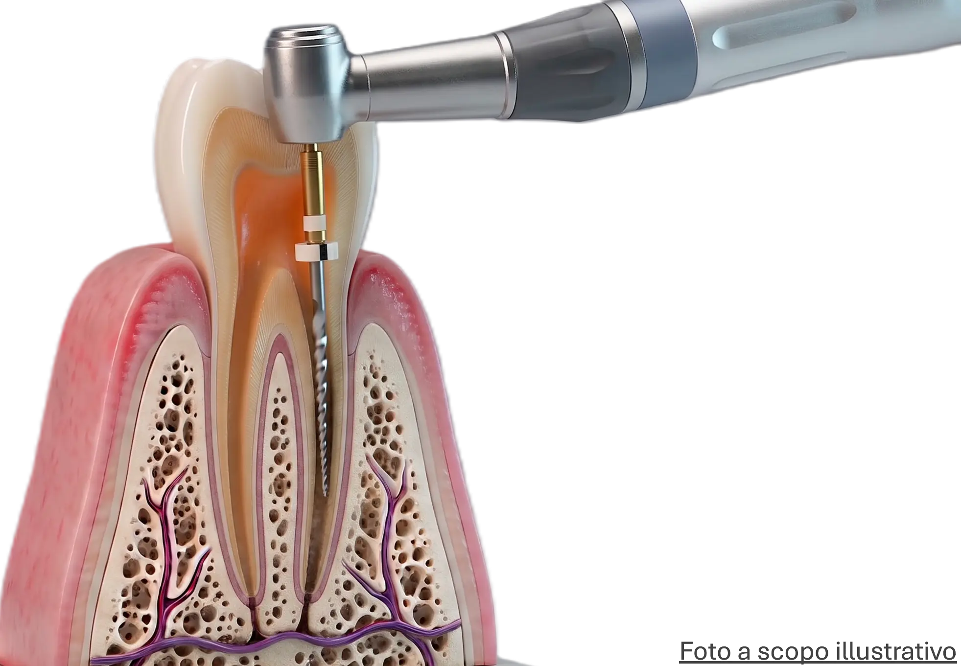 Endodonzia 1