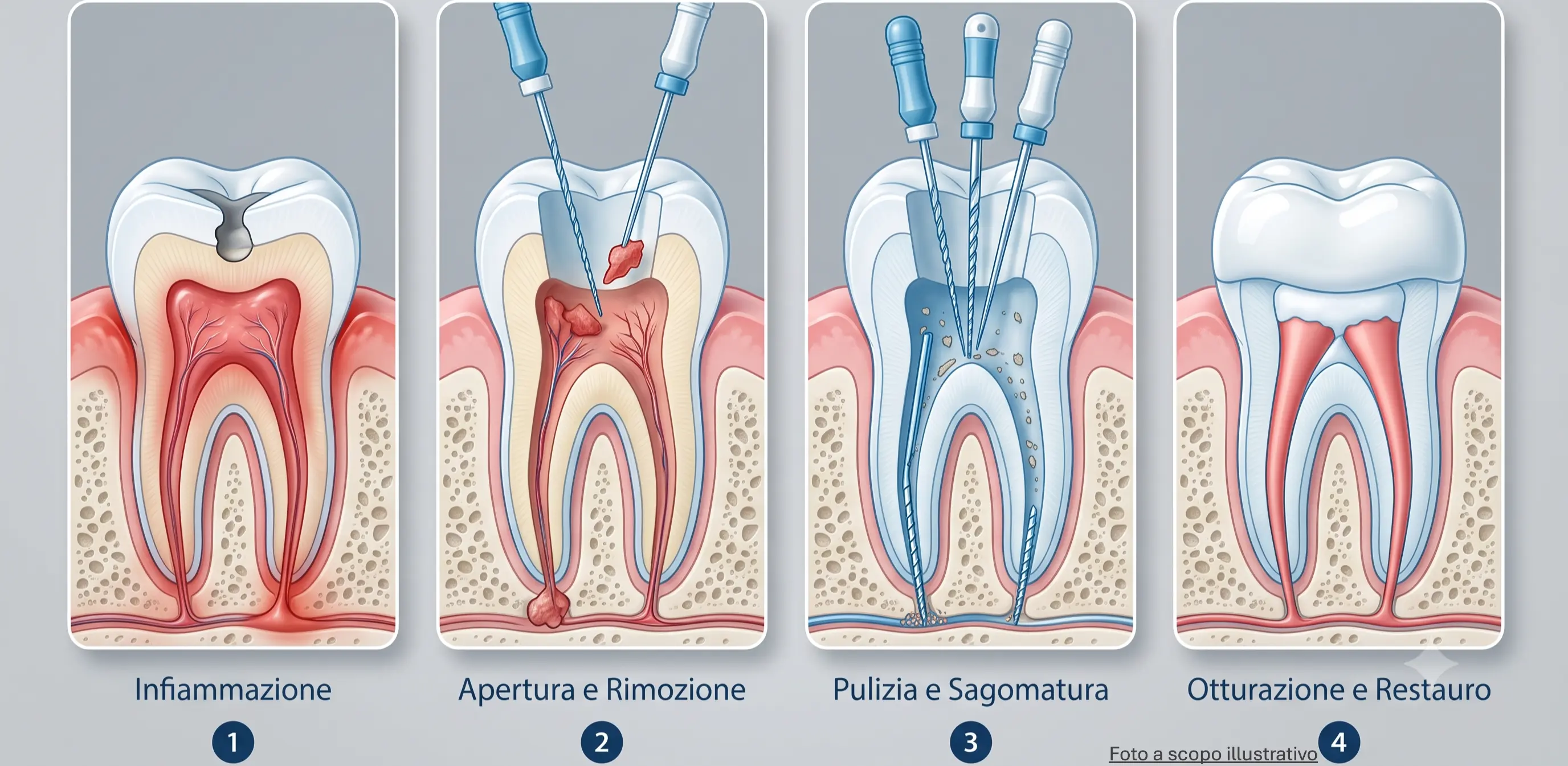 Endodonzia 2